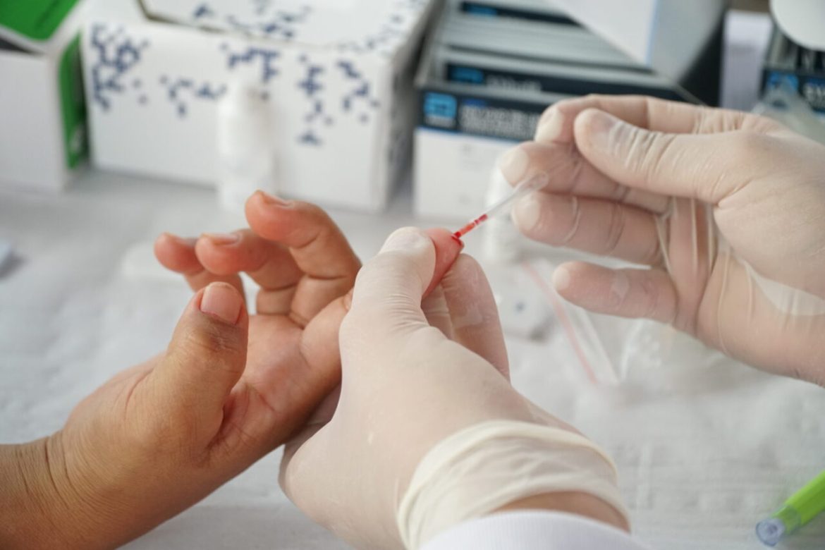 sesau-orienta-sobre-diferenca-entre-hiv-e-aids,-e-como-prevenir-e-tratar-o-virus